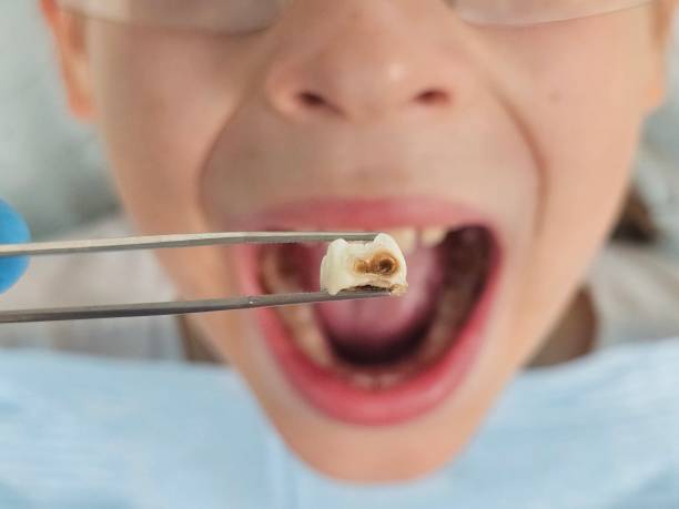 Best Urgent Tooth Repair  in Franklin, OH