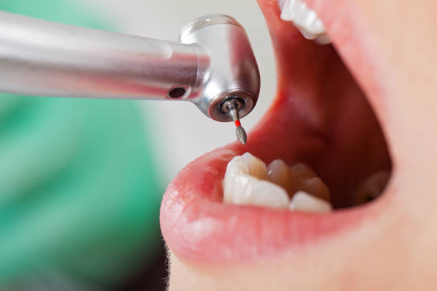 Best Cracked Tooth Emergency Dentist  in Franklin, OH